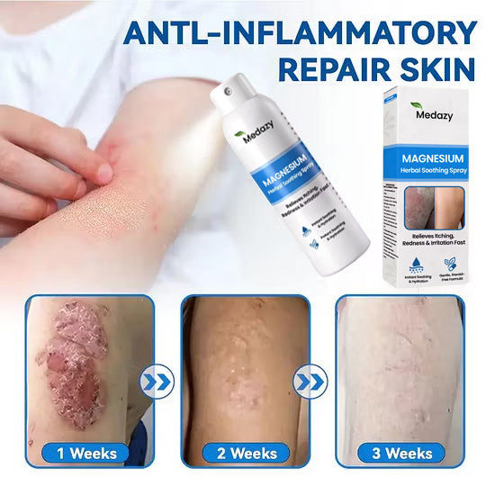 ✅ Official Store: Medazy® Magnesium Herbal Spray – Fast Relief for Psoriasis & Eczema | No-Rub, Steroid-Free