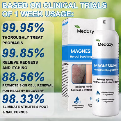 ✅ Official Store: Medazy® Magnesium Herbal Spray – Fast Relief for Psoriasis & Eczema | No-Rub, Steroid-Free