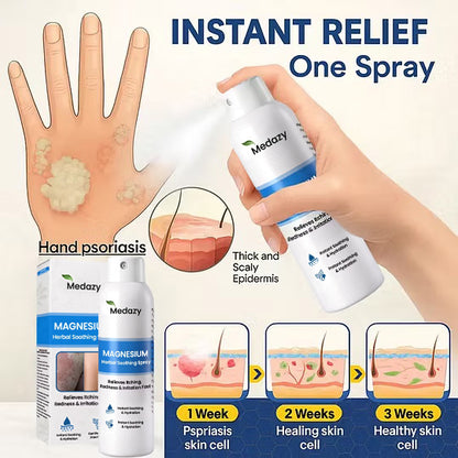 ✅ Official Store: Medazy® Magnesium Herbal Spray – Fast Relief for Psoriasis & Eczema | No-Rub, Steroid-Free