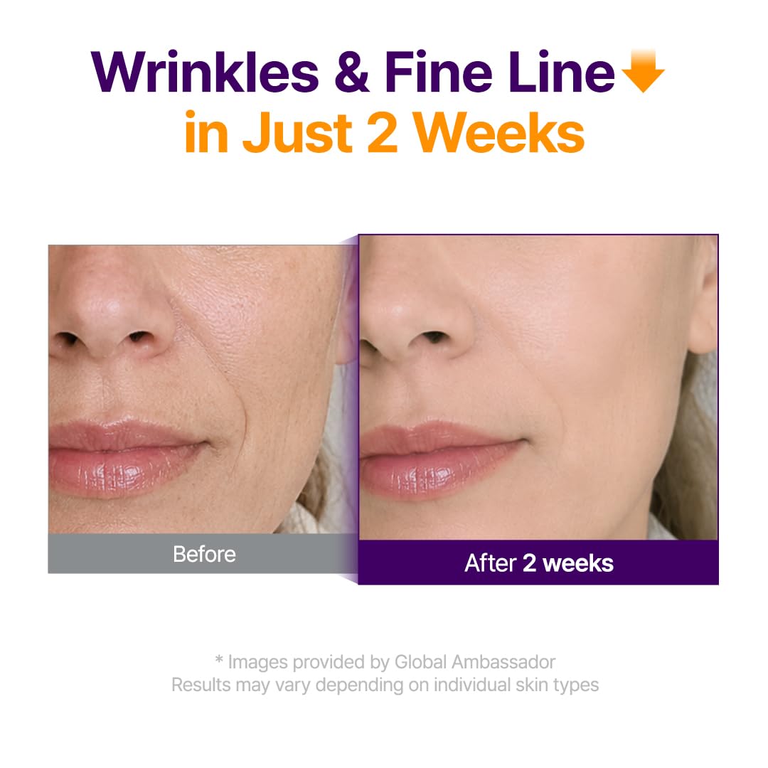 Before and after two week wrinkle and fine line appearance comparison