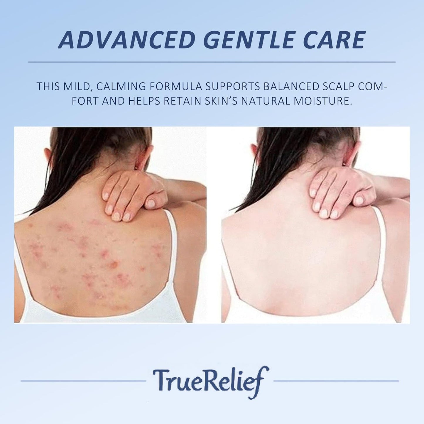 【🔥BOGO】Folliculitis Cream for Men & Women| Post-Shave Bump Relief Moisturizer for Face, Neck, Bikini Line & Buttocks