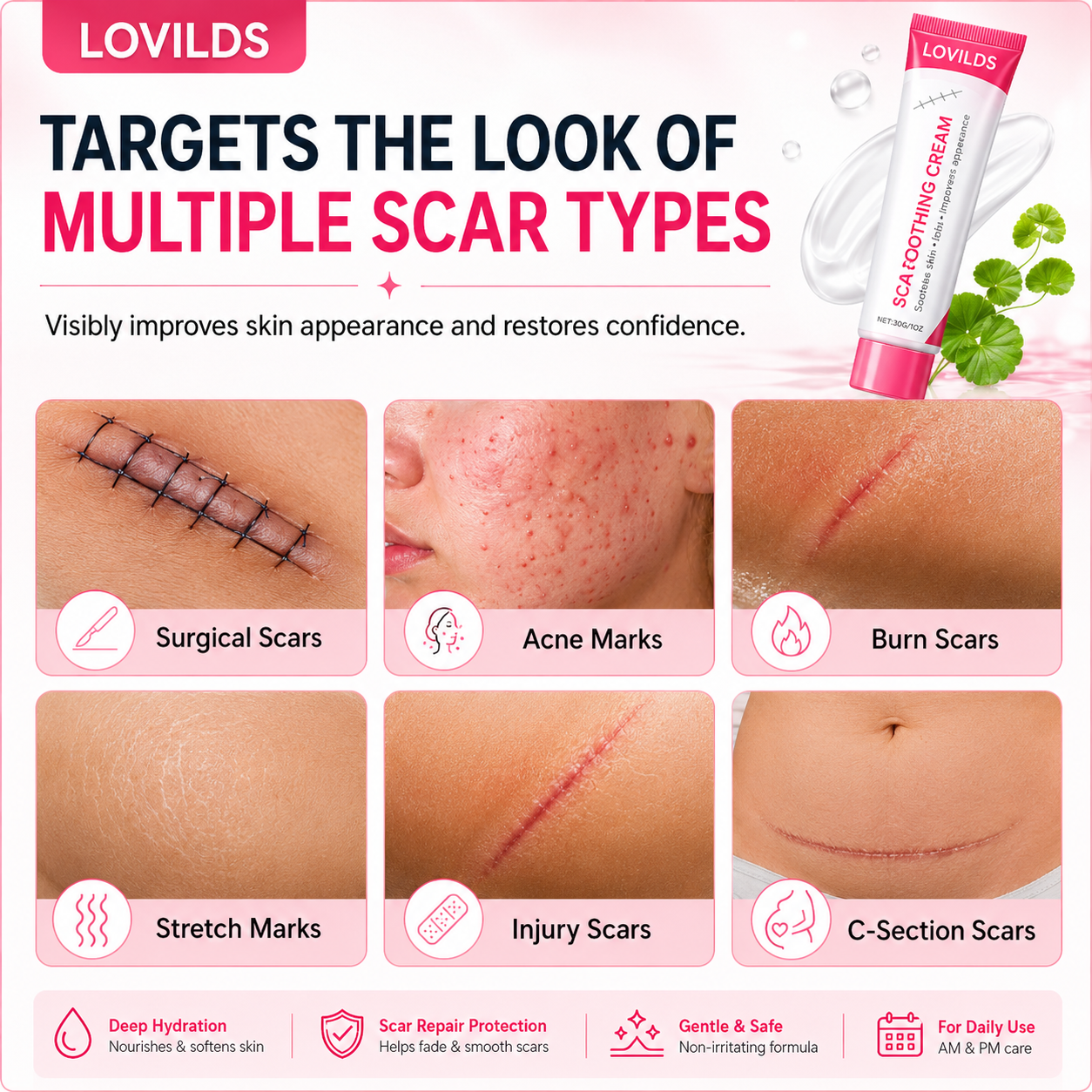 Scar free wart removal cream