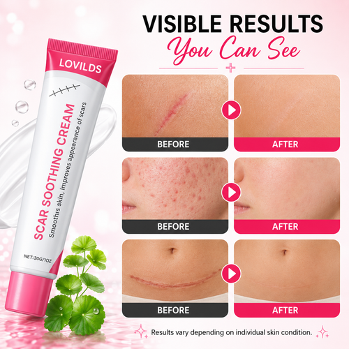 Scar free wart removal cream