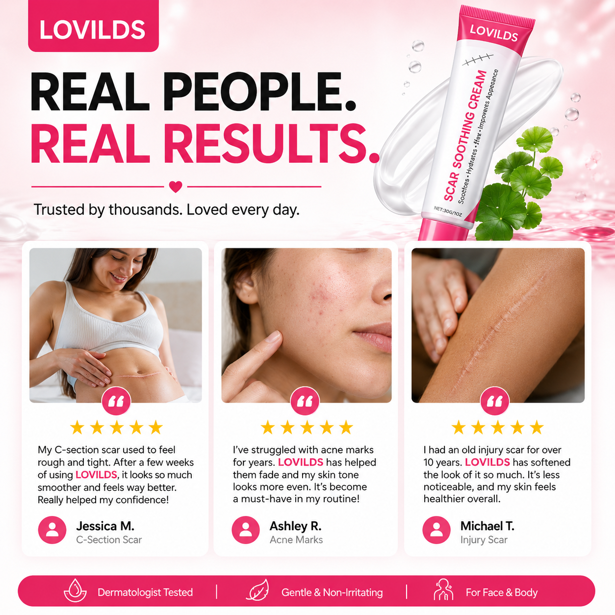 Scar free wart removal cream