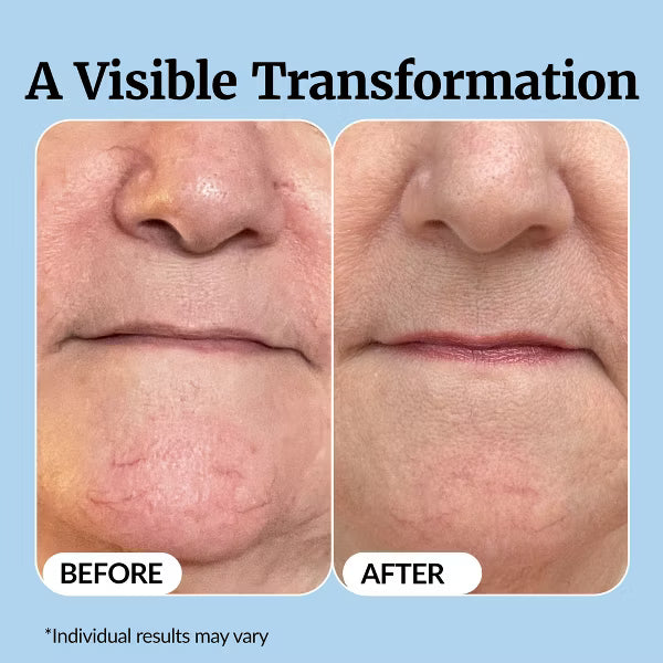 Vaxflite Super C Serum for Mature Skin - All-in-One Vitamin Formula Hydrates