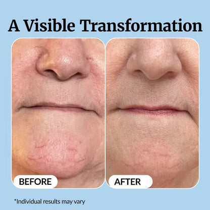 Vaxflite Super C Serum for Mature Skin - All-in-One Vitamin Formula Hydrates