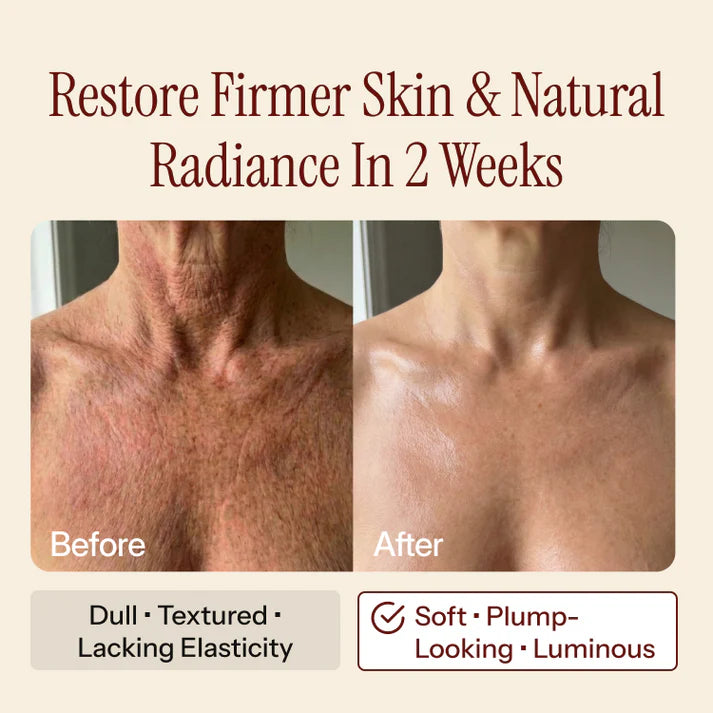 Before and after comparison showing the neck and chest area