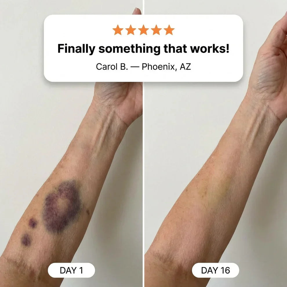 💥50K+ SOLD💕- Bruise Repair & Skin-Strengthening Cream