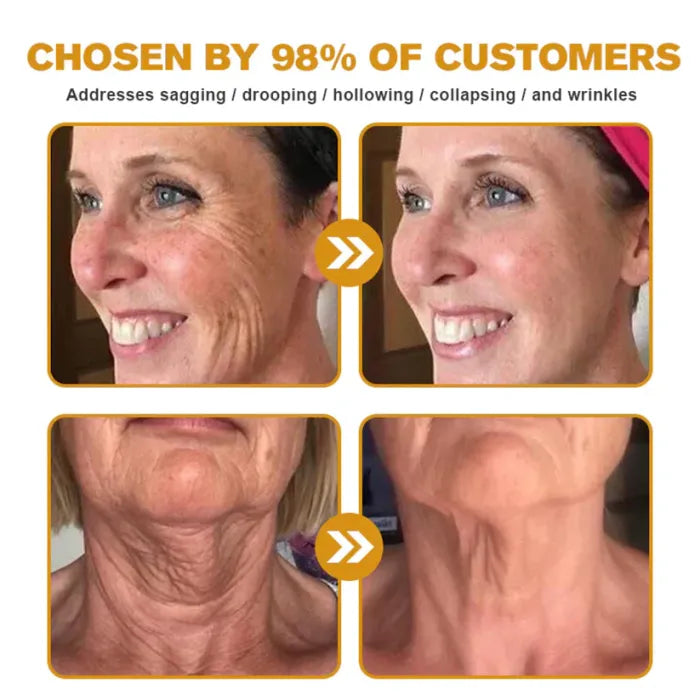 Before and after style skin smoothing results