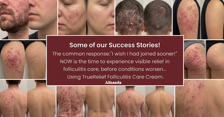 Calm the bumps. Clear the look. Get back to bare skin.